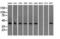 Sterol O-Acyltransferase 2 antibody, LS-C115247, Lifespan Biosciences, Western Blot image 