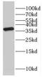 Guanosine Monophosphate Reductase antibody, FNab03528, FineTest, Western Blot image 