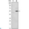 Eukaryotic Translation Initiation Factor 2 Alpha Kinase 3 antibody, LS-C812739, Lifespan Biosciences, Western Blot image 