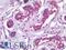 Tumor Protein P63 antibody, LS-A12938, Lifespan Biosciences, Immunohistochemistry paraffin image 