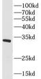 CAC antibody, FNab07934, FineTest, Western Blot image 