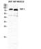 Seprase antibody, PA5-51057, Invitrogen Antibodies, Western Blot image 