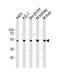 CLN3 Lysosomal/Endosomal Transmembrane Protein, Battenin antibody, PA5-49382, Invitrogen Antibodies, Western Blot image 