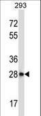 SCP 2 antibody, LS-C167123, Lifespan Biosciences, Western Blot image 