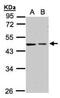 Galactokinase 2 antibody, NBP1-32508, Novus Biologicals, Western Blot image 