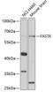 Fas-activated serine/threonine kinase antibody, 22-673, ProSci, Western Blot image 