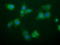 Nipsnap Homolog 2 antibody, LS-C787726, Lifespan Biosciences, Immunofluorescence image 