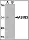 TNFAIP3 Interacting Protein 3 antibody, AP23892PU-N, Origene, Western Blot image 