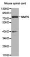 Matrix Metallopeptidase 9 antibody, TA327267, Origene, Western Blot image 