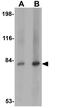 SAE2 antibody, GTX31413, GeneTex, Western Blot image 