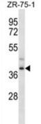 Formyl Peptide Receptor 3 antibody, abx027122, Abbexa, Western Blot image 