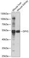 Dihydropyrimidinase antibody, GTX54041, GeneTex, Western Blot image 