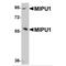 Zinc finger protein 667 antibody, MBS150181, MyBioSource, Western Blot image 