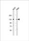 Zinc Finger And BTB Domain Containing 11 antibody, PA5-48591, Invitrogen Antibodies, Western Blot image 