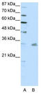 Pituitary homeobox 3 antibody, TA343498, Origene, Western Blot image 