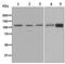 Leucine Rich Repeat Containing G Protein-Coupled Receptor 6 antibody, ab126747, Abcam, Western Blot image 