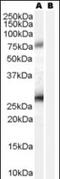Receptor-binding cancer antigen expressed on SiSo cells antibody, orb88444, Biorbyt, Western Blot image 