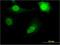 Ribosomal Protein L11 antibody, H00006135-M04, Novus Biologicals, Immunofluorescence image 