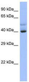 Scm Polycomb Group Protein Like 4 antibody, TA343691, Origene, Western Blot image 