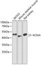 Potassium Voltage-Gated Channel Subfamily J Member 4 antibody, 15-322, ProSci, Western Blot image 