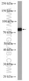 Iduronidase Alpha-L- antibody, 55158-1-AP, Proteintech Group, Western Blot image 