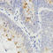 Receptor activity-modifying protein 2 antibody, A04768, Boster Biological Technology, Immunohistochemistry paraffin image 