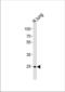 Cyclin Dependent Kinase 4 antibody, TA328198, Origene, Western Blot image 