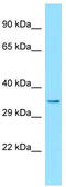ERI1 Exoribonuclease Family Member 3 antibody, TA337990, Origene, Western Blot image 