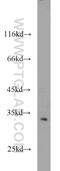 Cyclin Dependent Kinase 5 antibody, 10430-1-AP, Proteintech Group, Western Blot image 