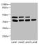 Ubiquitin Conjugating Enzyme E2 Z antibody, LS-C676676, Lifespan Biosciences, Western Blot image 