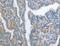 AP2S1 antibody, LS-C404522, Lifespan Biosciences, Immunohistochemistry paraffin image 