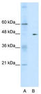 GDP Dissociation Inhibitor 2 antibody, TA330442, Origene, Western Blot image 