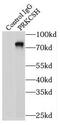 Protein Kinase C Substrate 80K-H antibody, FNab06784, FineTest, Immunoprecipitation image 