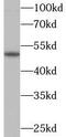 Parkin RBR E3 Ubiquitin Protein Ligase antibody, FNab06149, FineTest, Western Blot image 