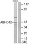 Abhydrolase Domain Containing 12 antibody, TA313208, Origene, Western Blot image 