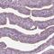 Coiled-Coil Domain Containing 114 antibody, NBP1-93863, Novus Biologicals, Immunohistochemistry frozen image 