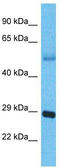 Aph-1 Homolog B, Gamma-Secretase Subunit antibody, TA335433, Origene, Western Blot image 