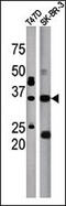 Isoprenylcysteine Carboxyl Methyltransferase antibody, 61-422, ProSci, Western Blot image 