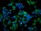 Ubiquitin-like-conjugating enzyme ATG3 antibody, MA5-25610, Invitrogen Antibodies, Immunocytochemistry image 