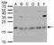 ChaC Cation Transport Regulator Homolog 2 antibody, GTX128819, GeneTex, Western Blot image 
