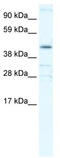 YY1 Transcription Factor antibody, TA330124, Origene, Western Blot image 