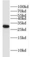 F-Box Protein 17 antibody, FNab03038, FineTest, Western Blot image 