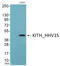 HSV Thymidine Kinase antibody, LS-C415730, Lifespan Biosciences, Western Blot image 