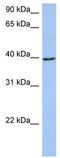 Acyl-CoA Dehydrogenase Medium Chain antibody, TA331167, Origene, Western Blot image 
