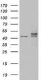 Casein Kinase 1 Epsilon antibody, TA803800, Origene, Western Blot image 