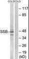 Small RNA Binding Exonuclease Protection Factor La antibody, orb95566, Biorbyt, Western Blot image 
