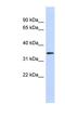 Olfactory Receptor Family 13 Subfamily C Member 5 antibody, NBP1-80011, Novus Biologicals, Western Blot image 