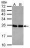 RAB33B, Member RAS Oncogene Family antibody, NBP2-20041, Novus Biologicals, Western Blot image 