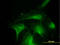 DnaJ Heat Shock Protein Family (Hsp40) Member A4 antibody, LS-B10984, Lifespan Biosciences, Immunofluorescence image 