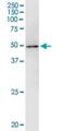 WAPL Cohesin Release Factor antibody, H00023063-M02, Novus Biologicals, Immunoprecipitation image 